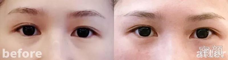 https://img.yiyiaimei.com/mnt/timg/200409/14434A229-7.jpg