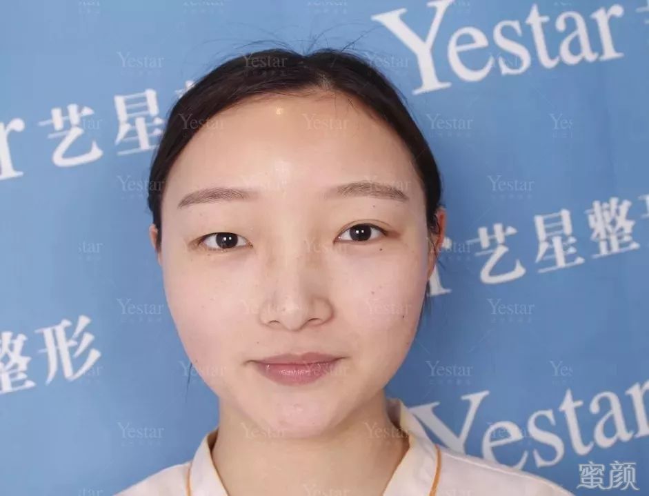 https://img.yiyiaimei.com/mnt/timg/200409/1456201P9-8.jpg