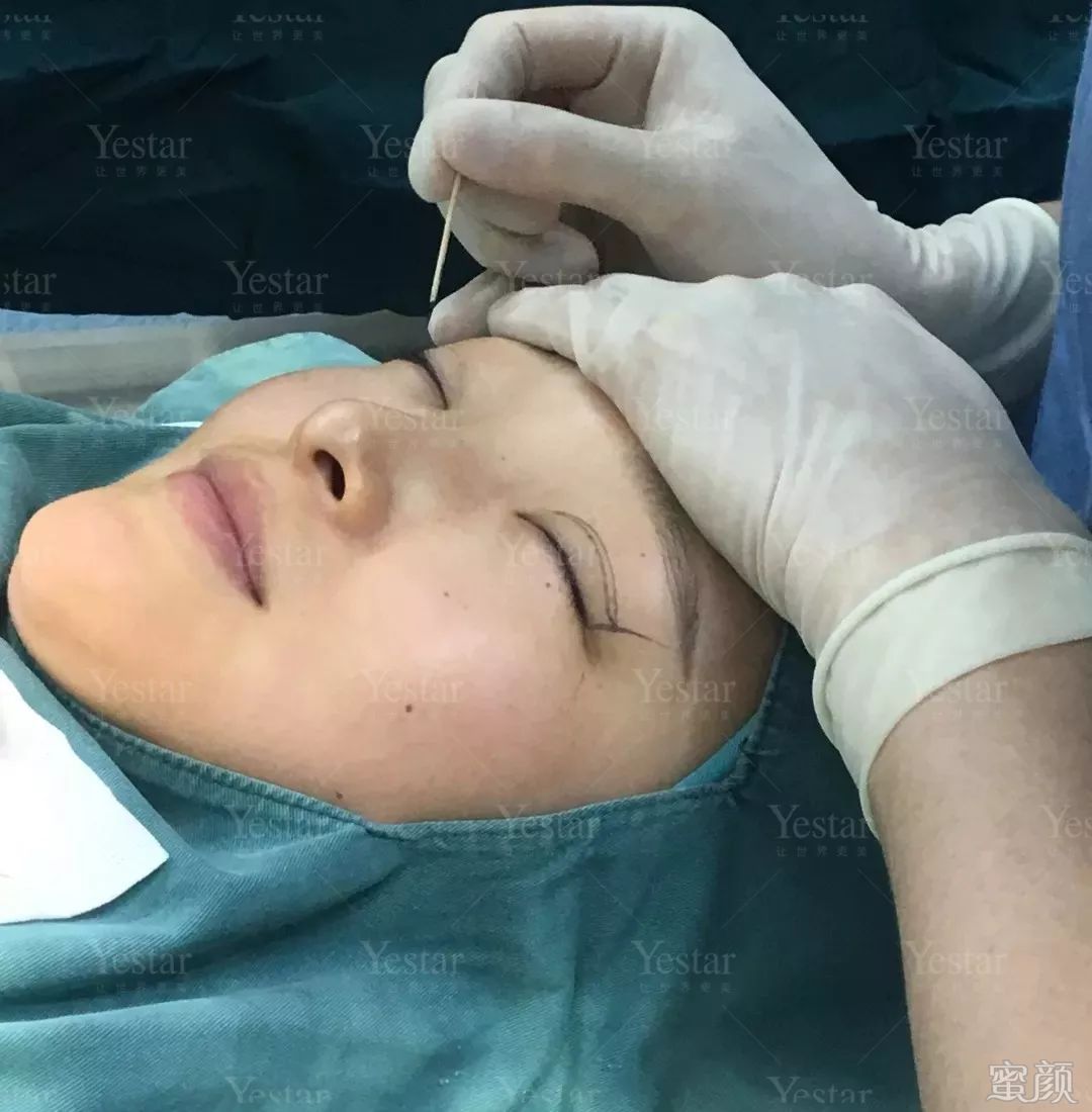 https://img.yiyiaimei.com/mnt/timg/200409/145620AY-9.jpg