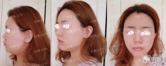 案例图片
