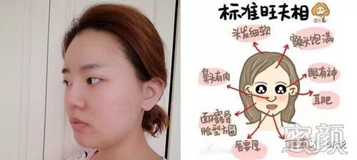 案例图片