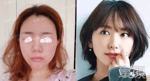 案例图片