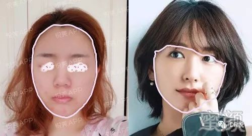 案例图片