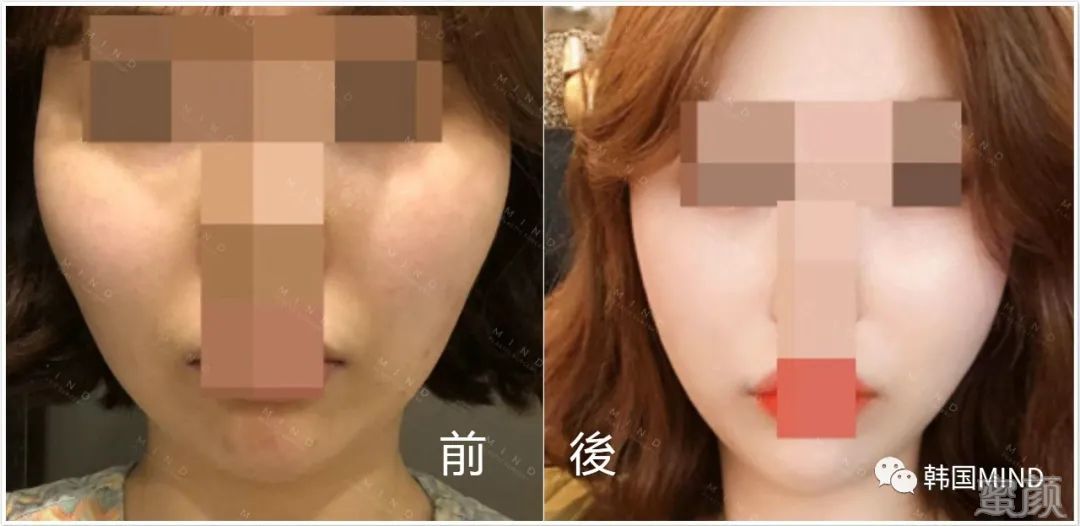 https://img.yiyiaimei.com/mnt/timg/200409/1J5241I7-11.jpg
