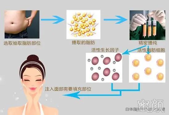 案例图片