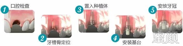 案例图片