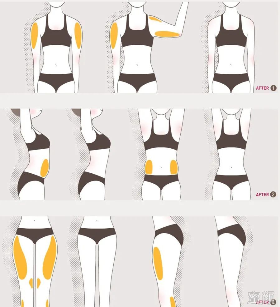 https://img.yiyiaimei.com/mnt/timg/200410/135U011S-4.jpg 案例图片