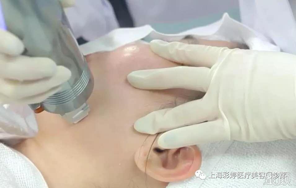 https://img.yiyiaimei.com/mnt/timg/200410/14003K619-7.jpg 案例图片