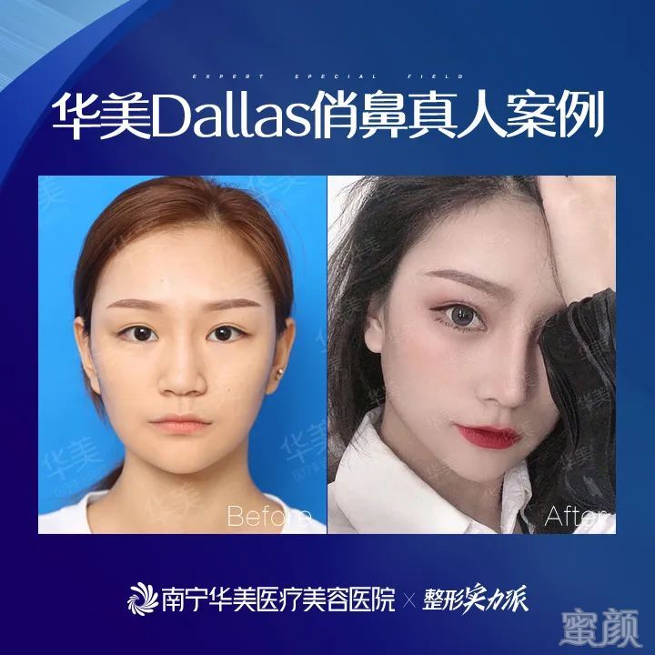 案例图片