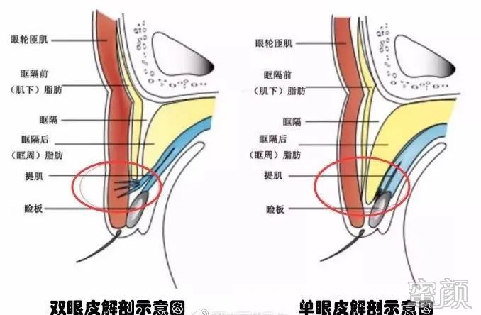 案例图片