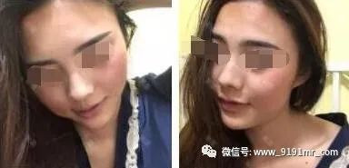 https://img.yiyiaimei.com/mnt/timg/200410/1535542162-1.jpg