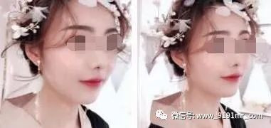 https://img.yiyiaimei.com/mnt/timg/200410/153555C28-4.jpg