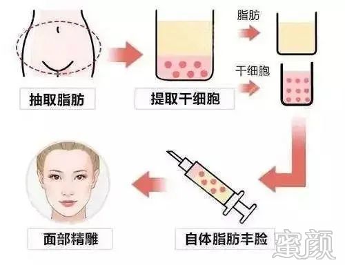 https://img.yiyiaimei.com/mnt/timg/200410/15404V203-3.jpg