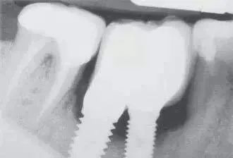 https://img.yiyiaimei.com/mnt/timg/200410/1542493959-4.jpg 案例图片