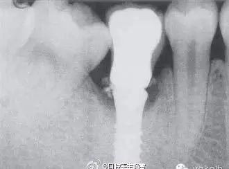 https://img.yiyiaimei.com/mnt/timg/200410/15424T064-2.jpg 案例图片