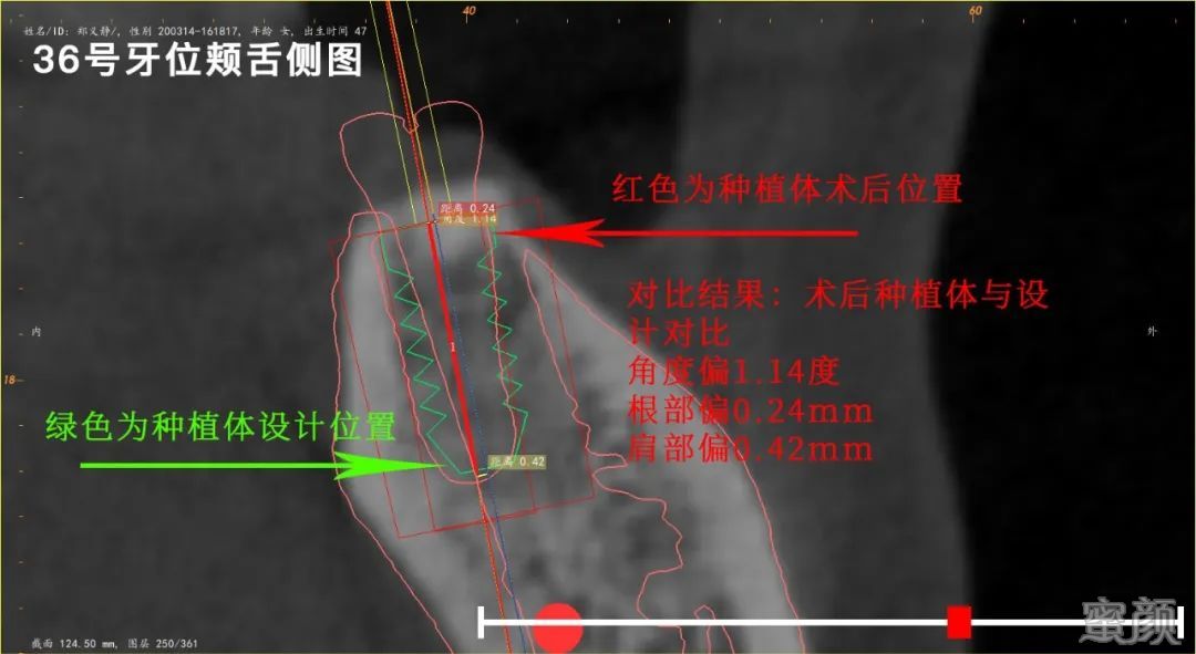 案例图片