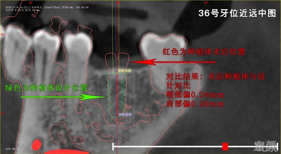 案例图片