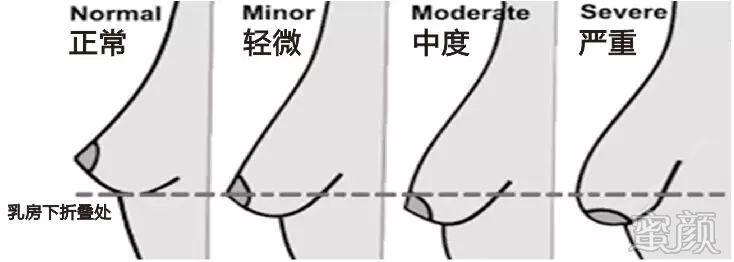 https://img.yiyiaimei.com/mnt/timg/200410/160H5L42-0.jpg