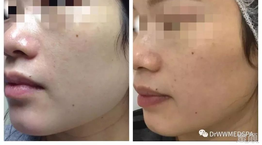 案例图片