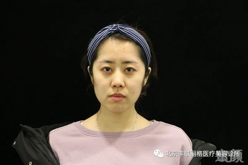 https://img.yiyiaimei.com/mnt/timg/200411/164K14344-2.jpg