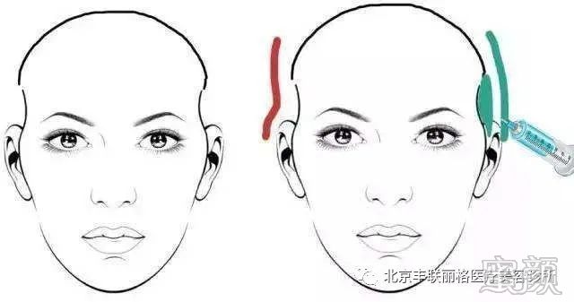 https://img.yiyiaimei.com/mnt/timg/200411/164K1Kb-3.jpg
