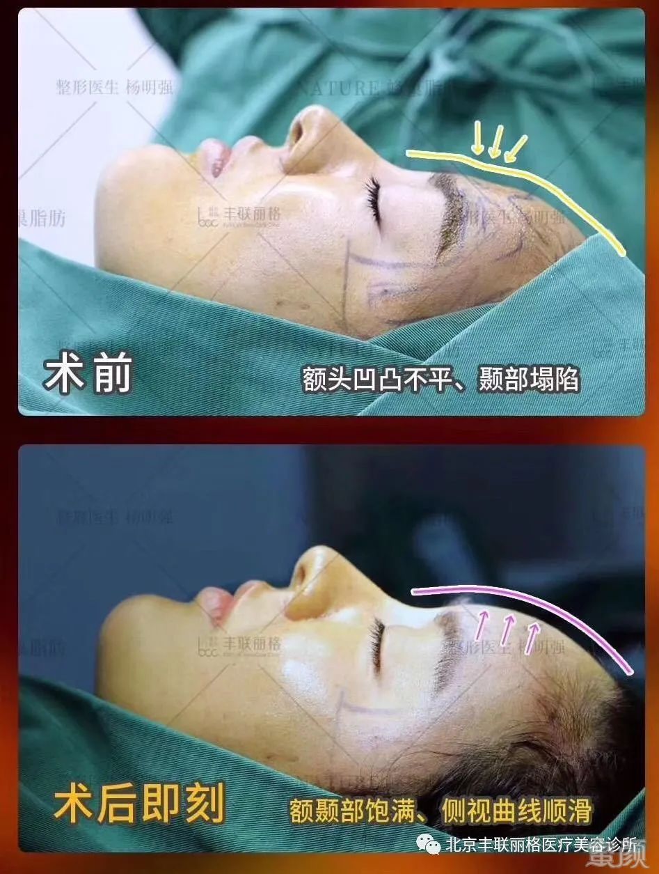 https://img.yiyiaimei.com/mnt/timg/200411/164K345R-5.jpg