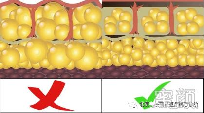 https://img.yiyiaimei.com/mnt/timg/200411/164K53K0-6.jpg