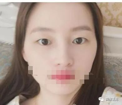 https://img.yiyiaimei.com/mnt/timg/200411/1Q34aC1-3.jpg