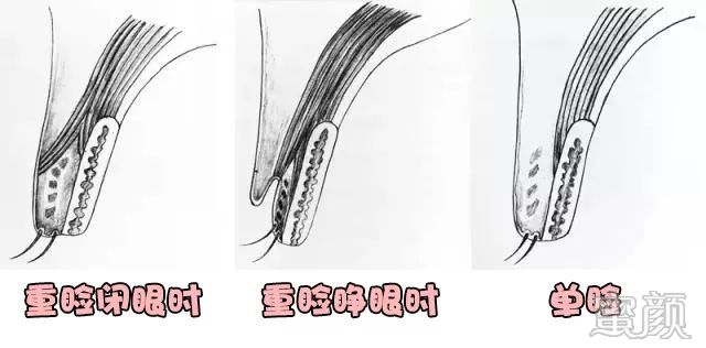 https://img.yiyiaimei.com/mnt/timg/200411/1R1315Q5-1.jpg