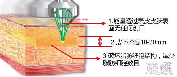 案例图片