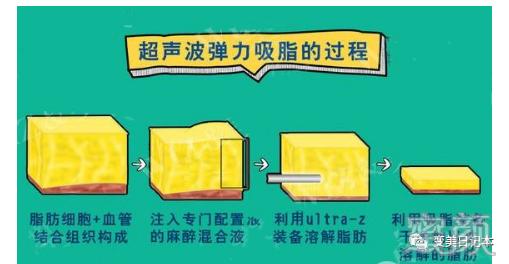 案例图片