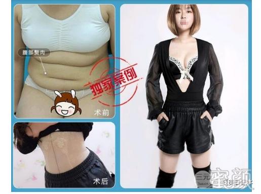 https://img.yiyiaimei.com/mnt/timg/200411/1U2395C1-4.jpg 案例图片
