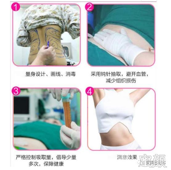 案例图片
