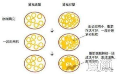 https://img.yiyiaimei.com/mnt/timg/200411/1U6211496-1.jpg