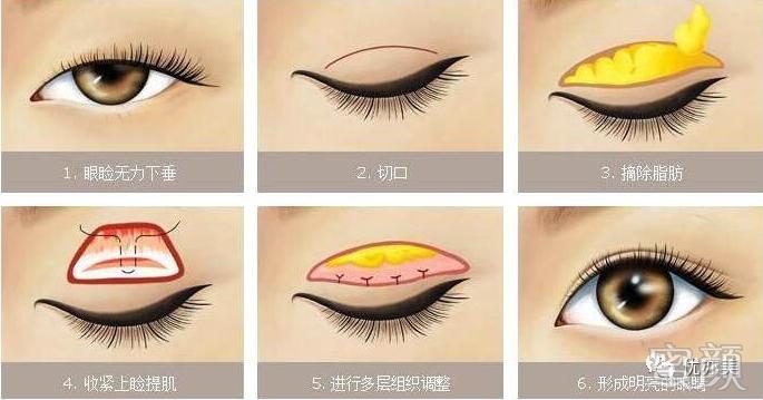 案例图片