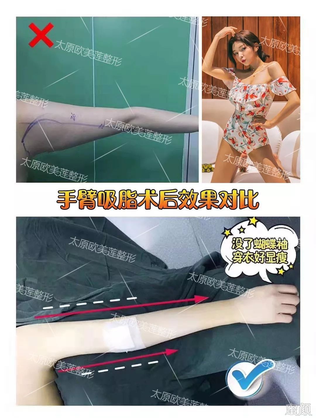 案例图片