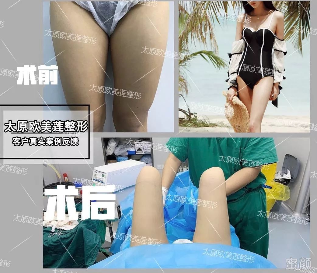 案例图片