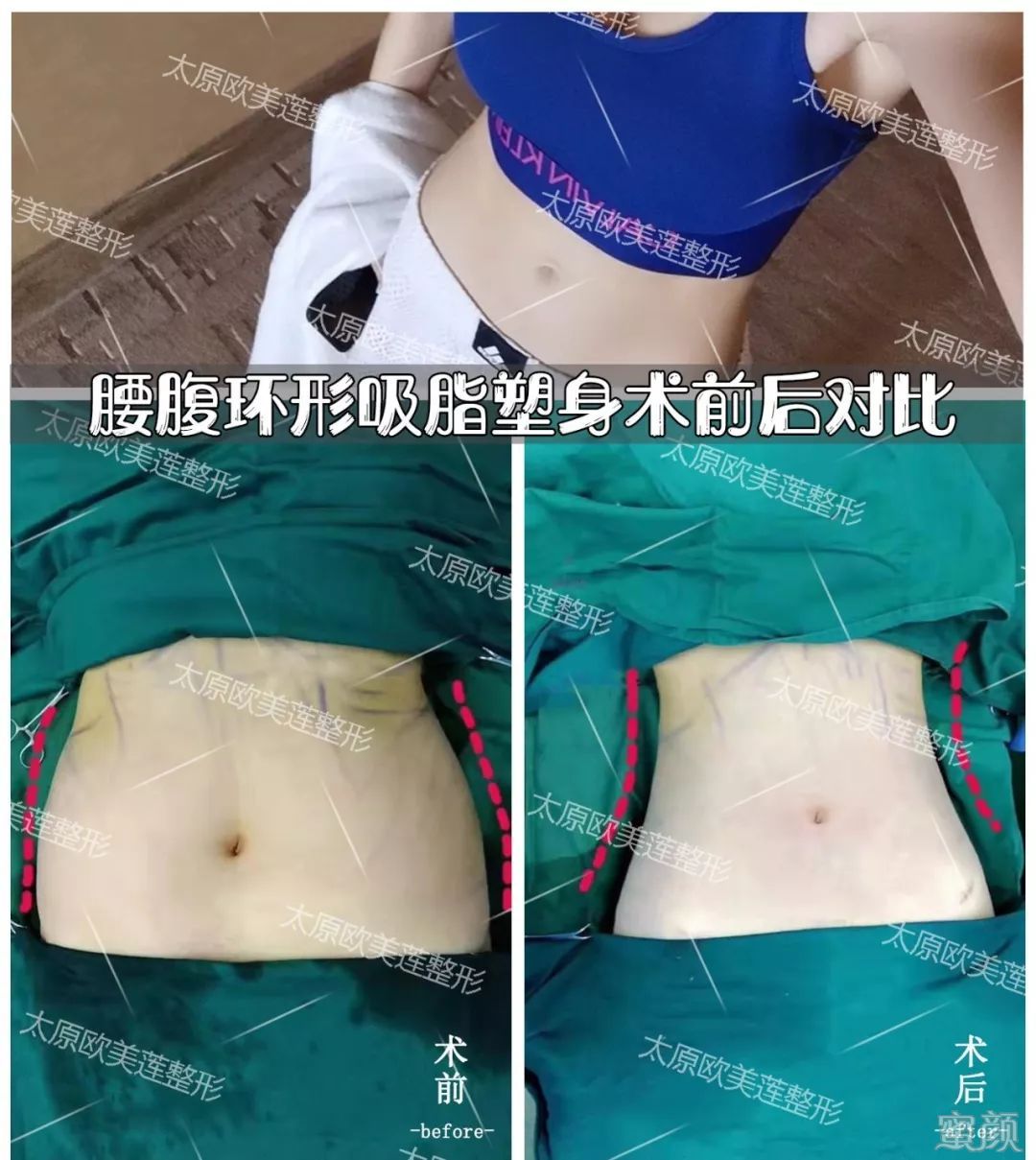 案例图片