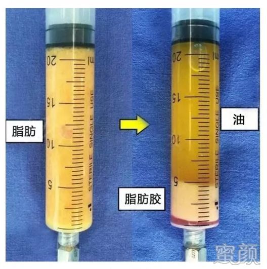 案例图片