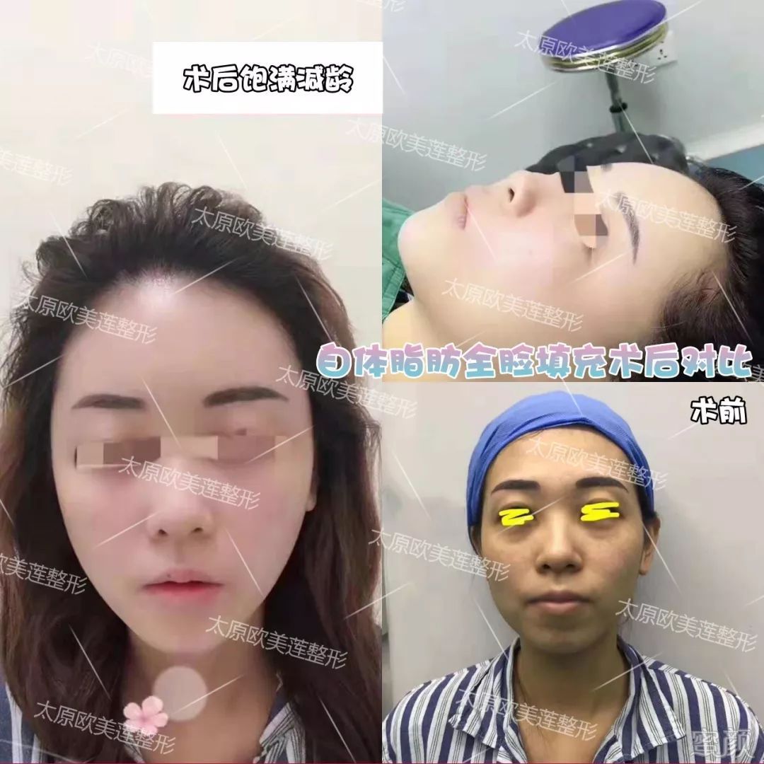 案例图片