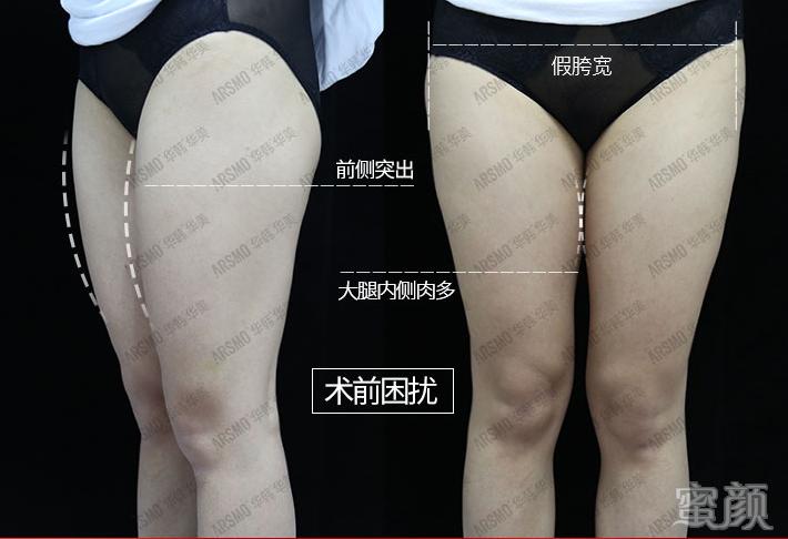 案例图片