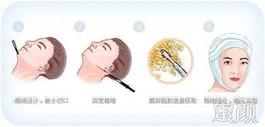 https://img.yiyiaimei.com/mnt/timg/200412/1245303c2-0.jpg