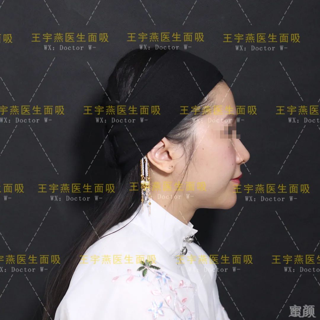 https://img.yiyiaimei.com/mnt/timg/200412/1245314630-3.jpg