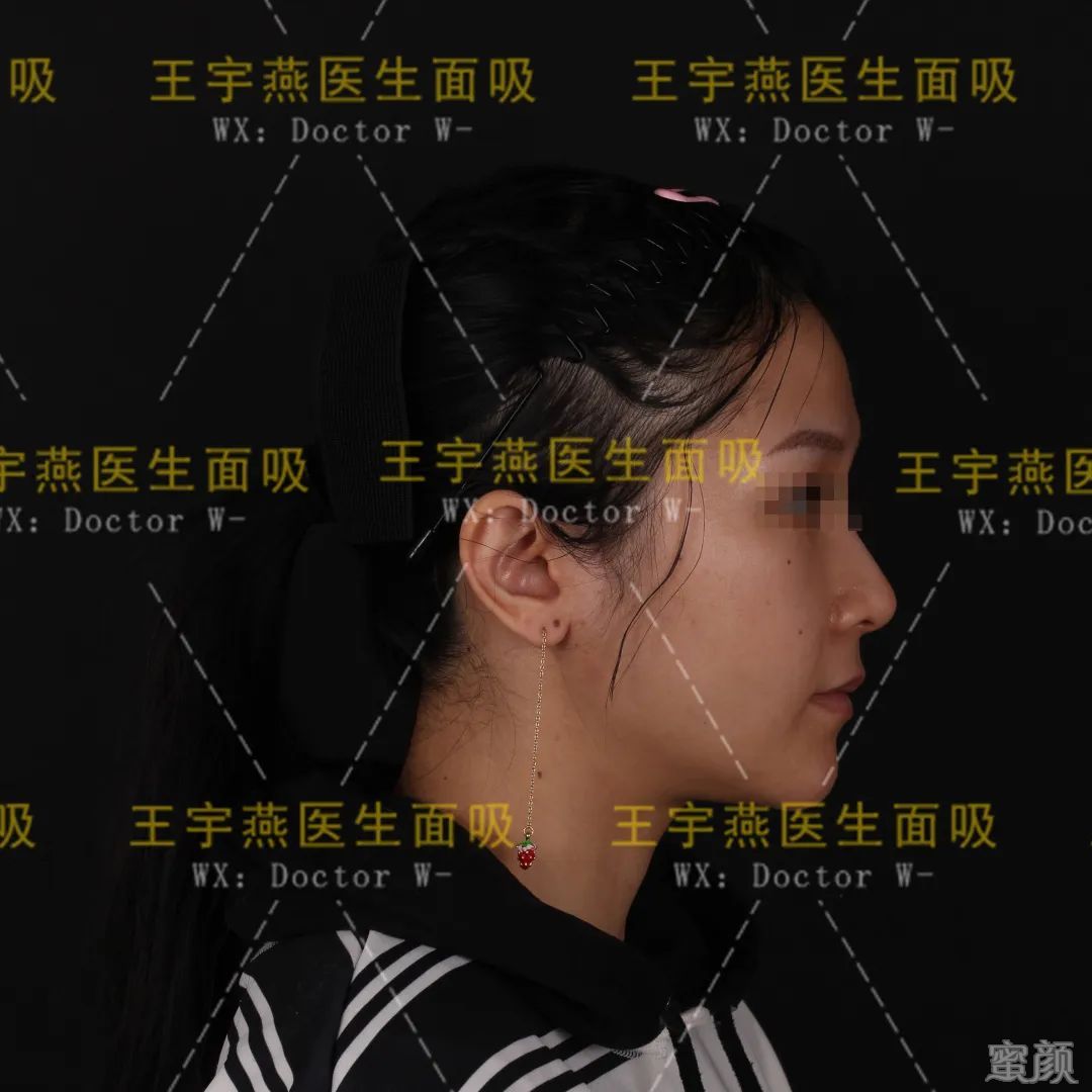 https://img.yiyiaimei.com/mnt/timg/200412/1245324495-4.jpg