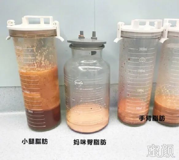 案例图片