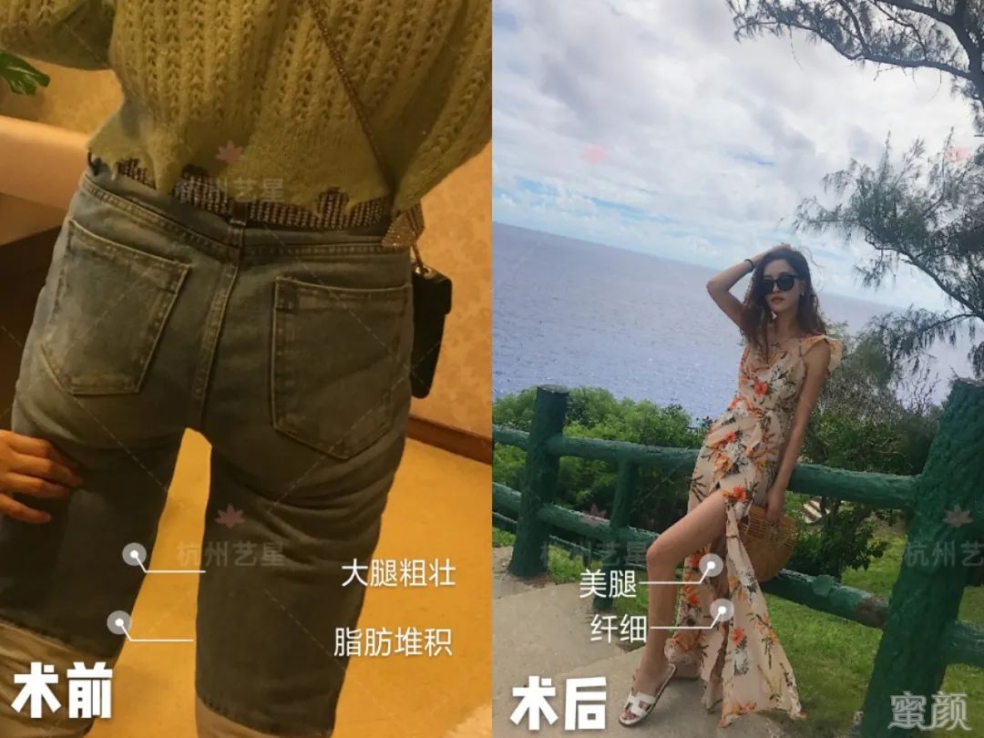案例图片