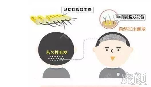 https://img.yiyiaimei.com/mnt/timg/200413/1531543629-1.jpg