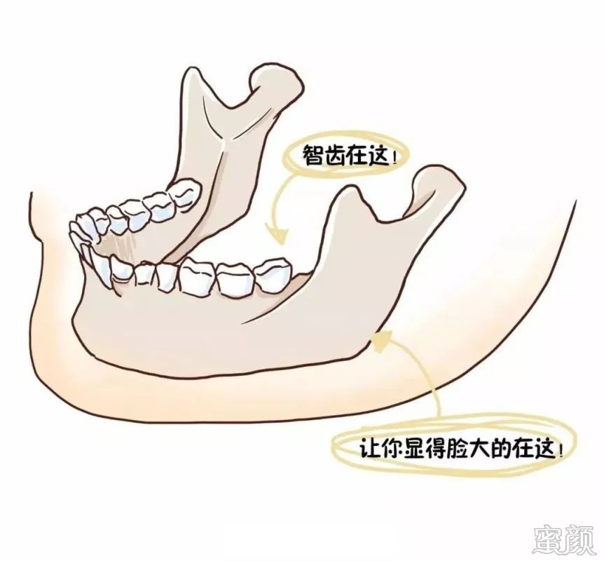 案例图片