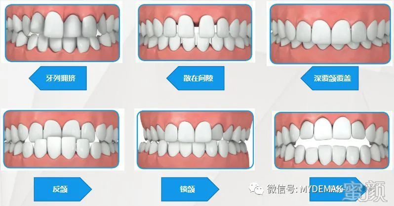 https://img.yiyiaimei.com/mnt/timg/200414/1440512523-0.jpg