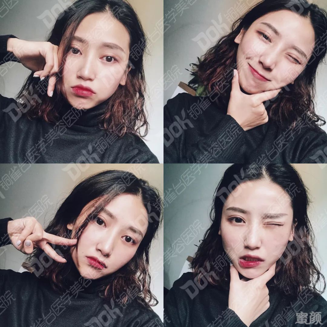 案例图片